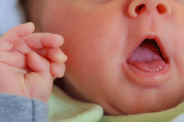 Higiene Oral do Bebê - Cuidados com a Boca do Bebê - Bebê com a boca aberta